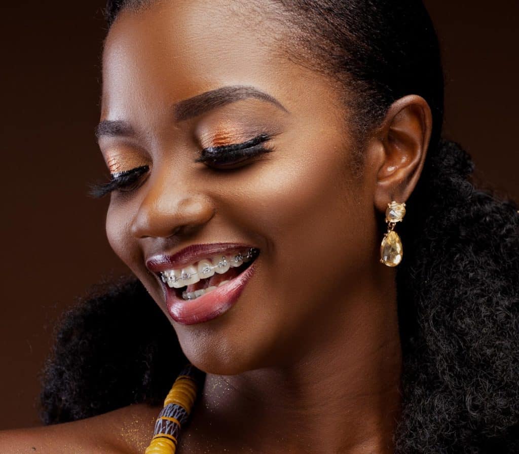 What are the Foods to Avoid With Braces?
