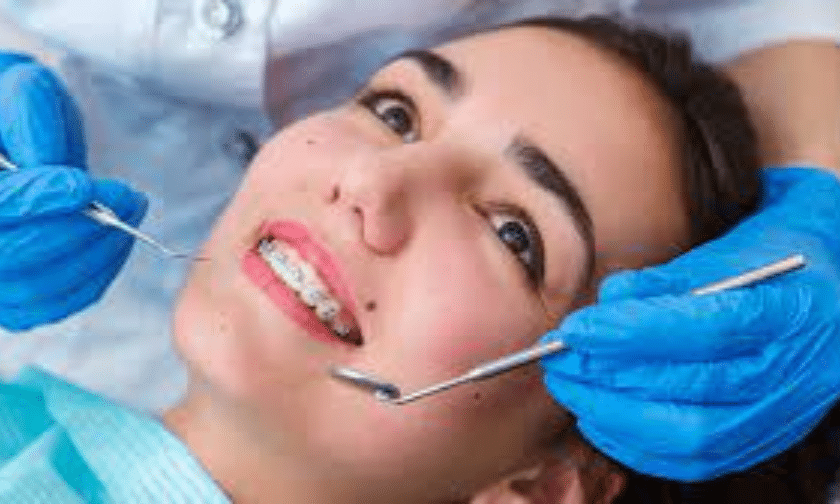 Everything You Need To Know About Adult Orthodontic Treatment