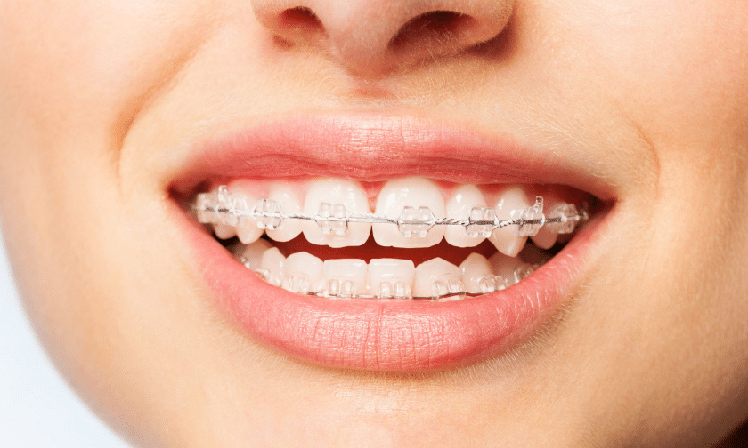 Here’s All You Need To Know About Orthodontic Care