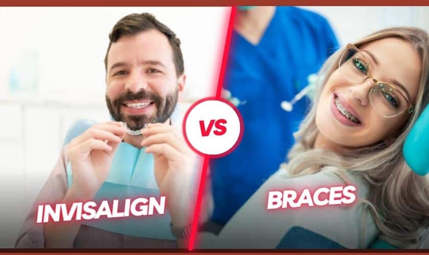 Invisalign vs. Braces What Are The Most Significant Differences?