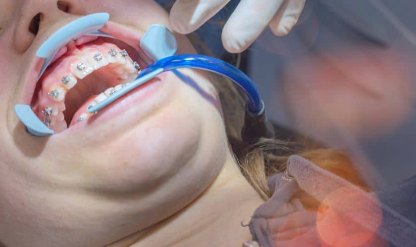 The Ultimate Guide To Choosing An Orthodontist In Woodbridge