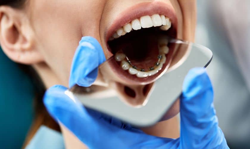 Navigating Workplace Etiquette: Tips For Adults With Braces