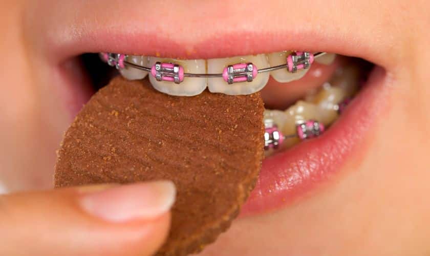 Braces in Woodbridge