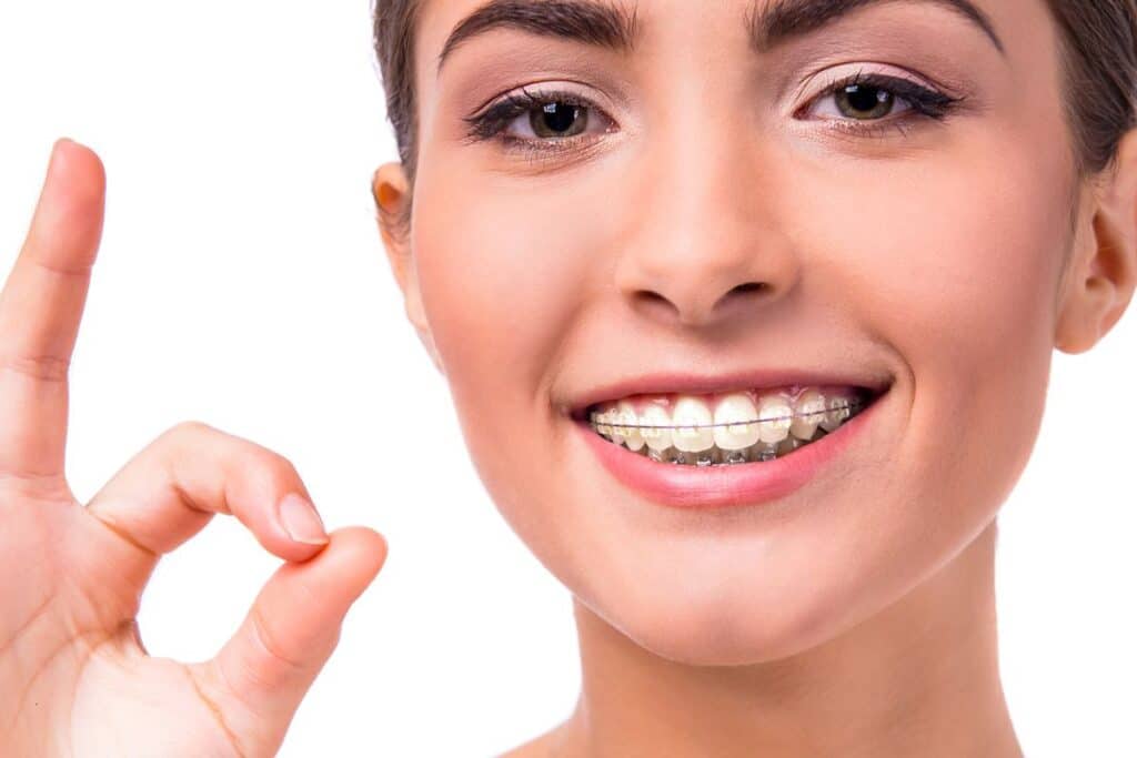 Clear braces Woodbridge