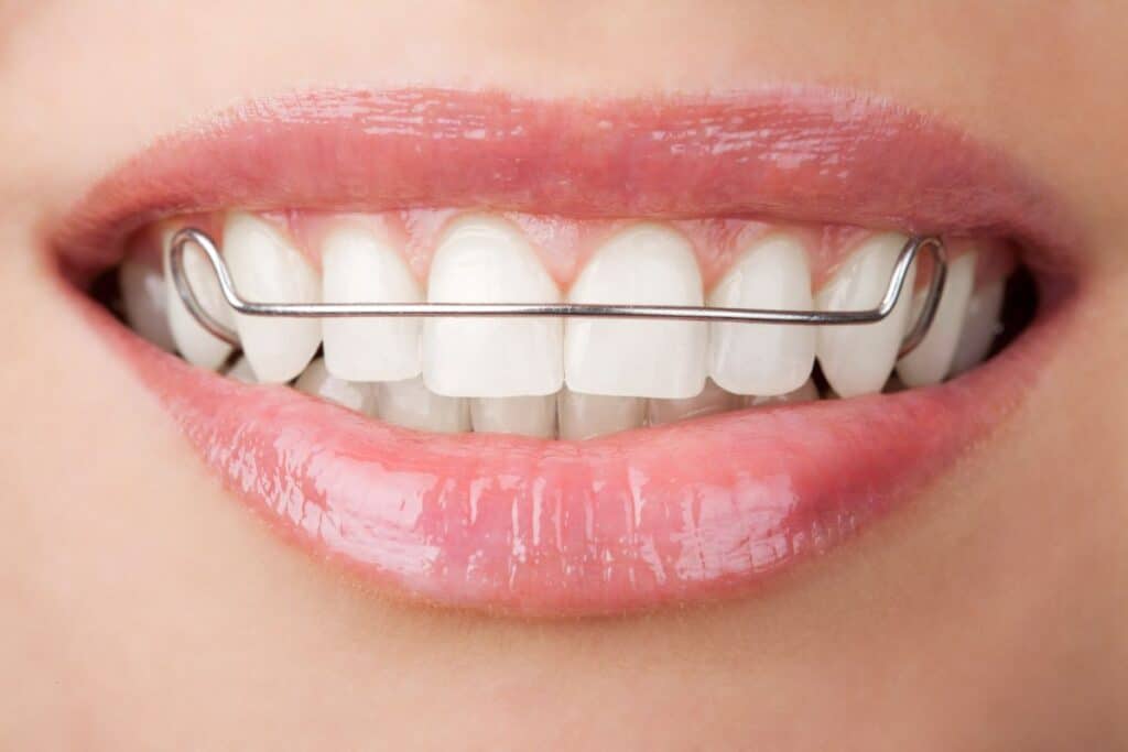 orthodontist in woodbridge