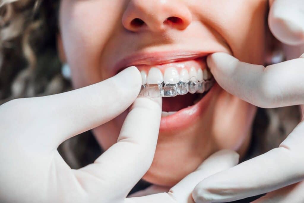 invisalign near me