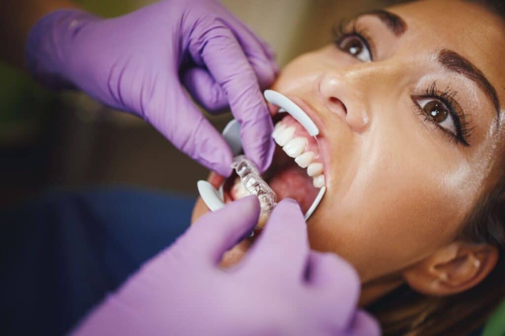 invisalign in portland