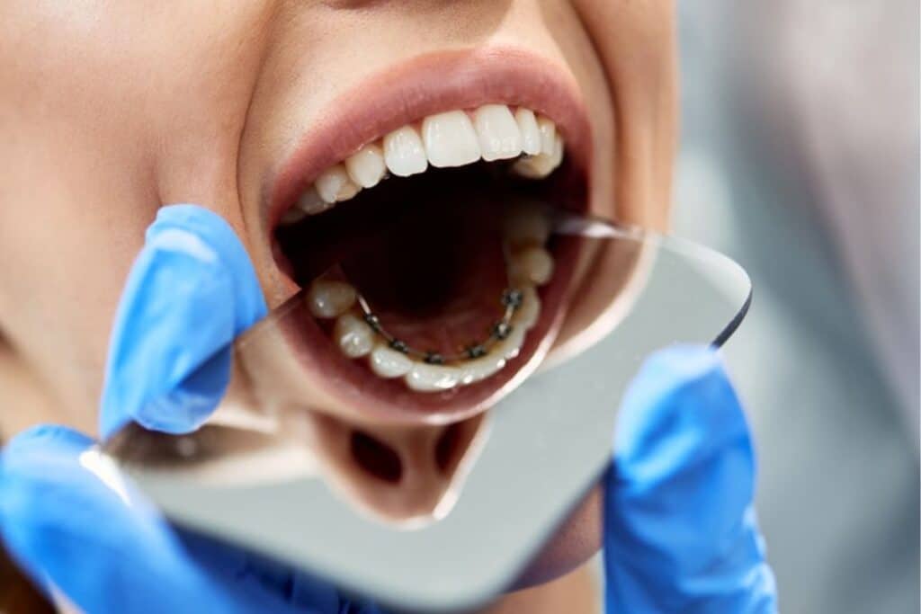 adult orthodontist in woodbridge