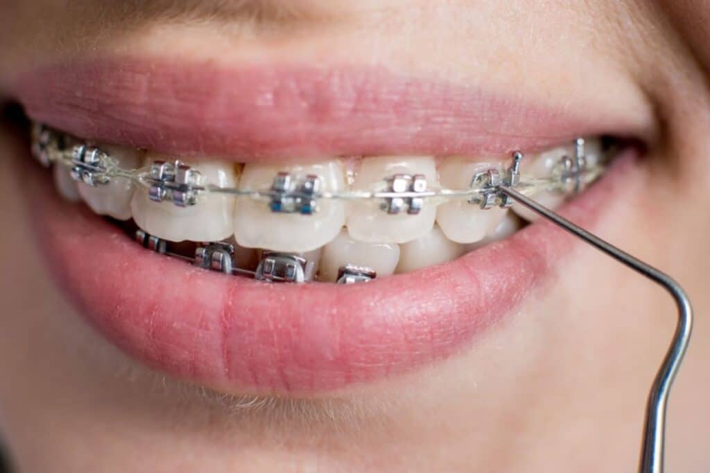 orthodontist near me