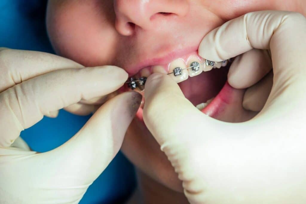 orthodontist woodbridge