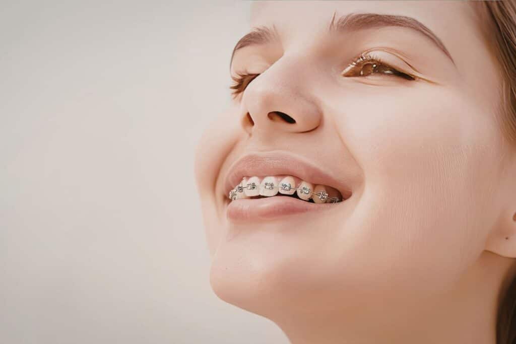 Braces