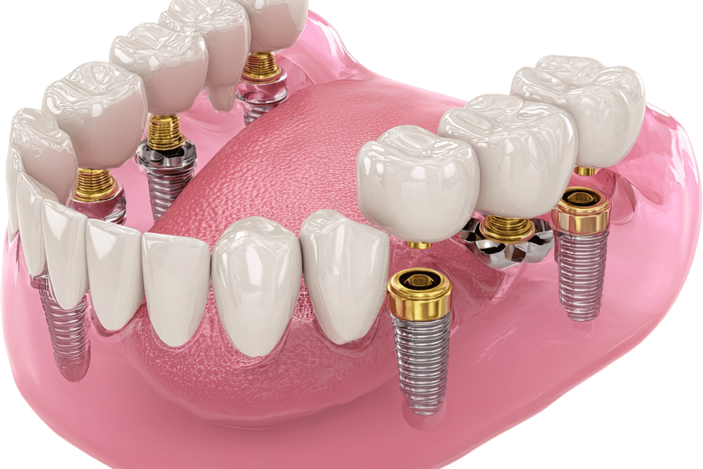 JAW MISALIGNMENT